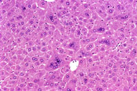 Multinucleated Hepatocytes