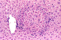 necrosis with an early inflammation cell infiltration at the periphery of the necrotic hepatocytes