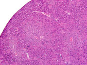 Medium magnification of a hepatodiaphragmatic nodule in a mouse.