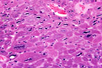 High magnification of a hepatodiaphragmatic nodule in a mouse.