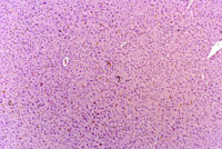 Pigmented Kupffer Cell