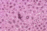 Multinucleated Hepatocytes