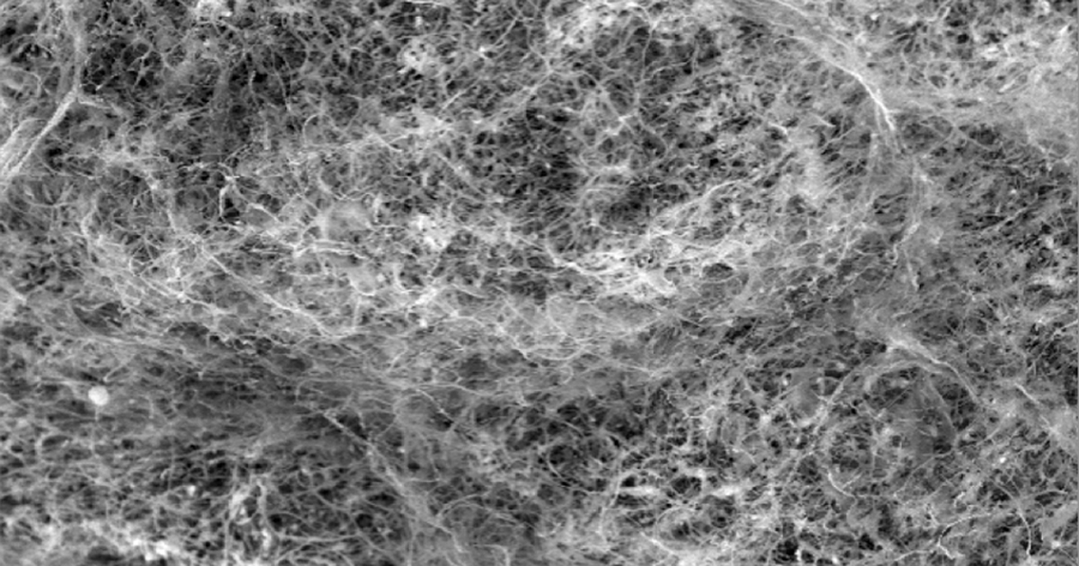 scanning electron microscope (SEM) image of mucins