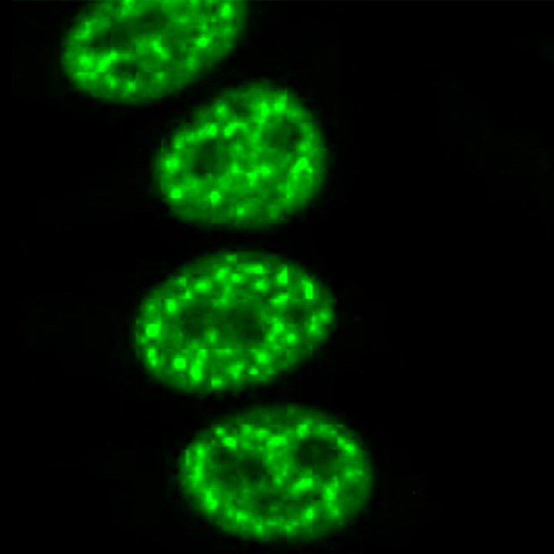 antinuclear antibodies (ANA)