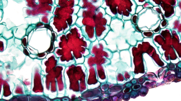 Cells under a microscope