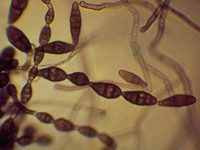 Alternaria
