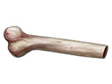 Femur thumb