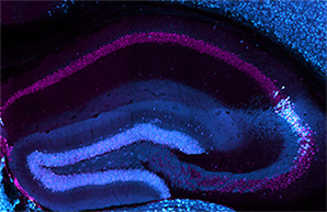 Mouse hippocampal neurons immuno-stained for with a marker of area CA2 (PCP4, blue) and expression of a stress hormone receptor (Mineralocorticoid Receptor; magenta)