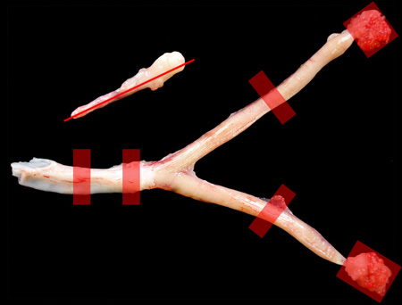 Female uterus bladder trimming examples