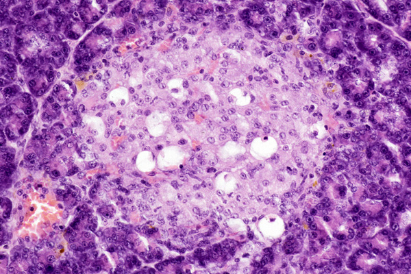 Toxicologic Pathology