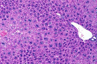 Hepatocyte Hypertrophy