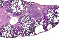 Dual Transgenic Mouse Liver