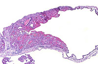 Crystalline Inclusions