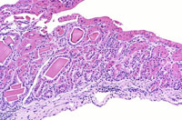 Crystalline Inclusions