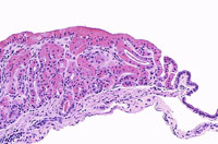 Crystalline Inclusions