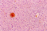 Minimal centrilobular hepatocyte hypertrophy is present and most dramatically involves enlargement of hepatocytes immediately adjacent to the central vein.