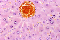 Minimal centrilobular hepatocyte hypertrophy is present. The periportal hepatocytes are not affected.