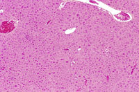 Generalized hepatocyte hypertrophy involving all portions of the hepatic lobule.