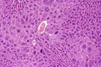 Hypertrophic and cytomegalic hepatocytes are present in the centrilobular and midlobular areas in these images from a mouse treated with chlordane for several months. Some cytomegalic hepatocytes have several nuclei.