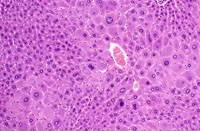 Hypertrophic and cytomegalic hepatocytes are present in the centrilobular and midlobular areas in these images from a mouse treated with chlordane for several months. Some cytomegalic hepatocytes have several nuclei.