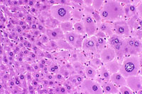 Hypertrophic and cytomegalic hepatocytes are present in the centrilobular and midlobular areas in these images from a mouse treated with chlordane for several months. Some cytomegalic hepatocytes have several nuclei.