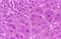 Hypertrophic and cytomegalic hepatocytes are present in the centrilobular and midlobular areas in these images from a mouse treated with chlordane for several months. Some cytomegalic hepatocytes have several nuclei.