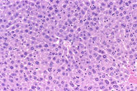 Liver Immersion Overnight