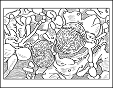 A White Blood Cell Fights a Bacteria (Staph aureus)