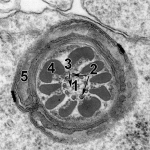 electron microscopy images that magnify these regions more than 1,000 times to reveal intricate details