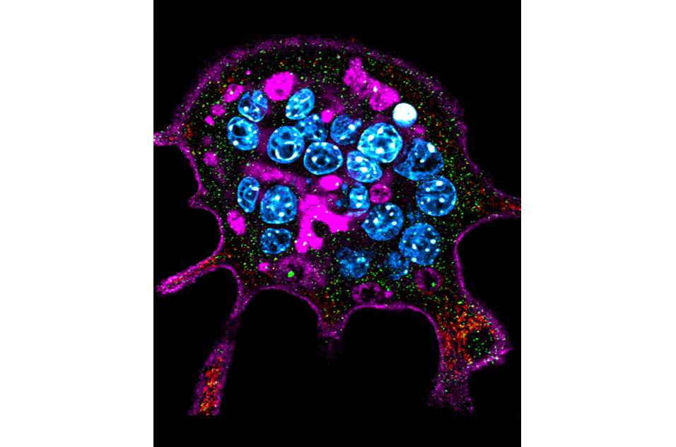 stained  multinuclear osteoclasts for phalloidin, mitochondria, DNA, and autophagosomes