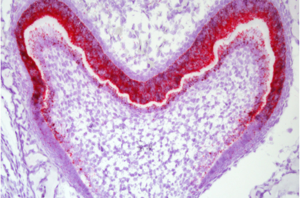 gene expression pattern during tooth morphogenesis in a tooth germ