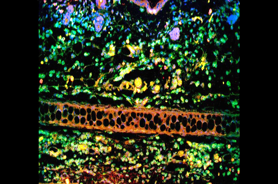 immune response during contact hypersensitivity on ear skin