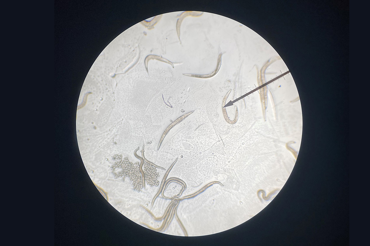 C. elegans transparent bodies as seen through a microscope.