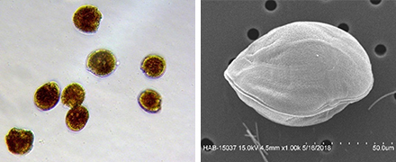 microscopic views of toxigenic Gambierdiscus silvae