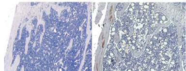 The image on the right shows an increased number of adipocytes, in white, in the bone marrow of TBT-treated mice, compared to the bone marrow of non-TBT-treated mice on the left. (Photo courtesy of Jennifer Schlezinger)