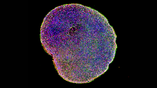 brain organoids contain different types of neurons, shown in different colors, to better represent the complexity of the human brain