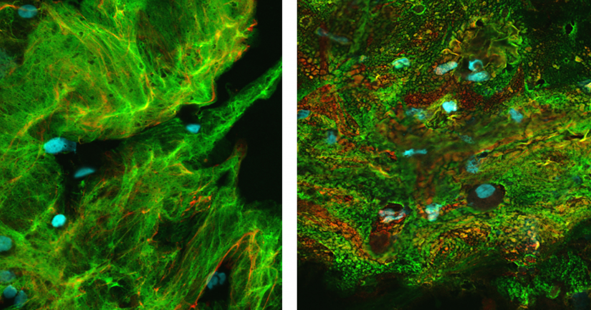 non-CF and CF flakes