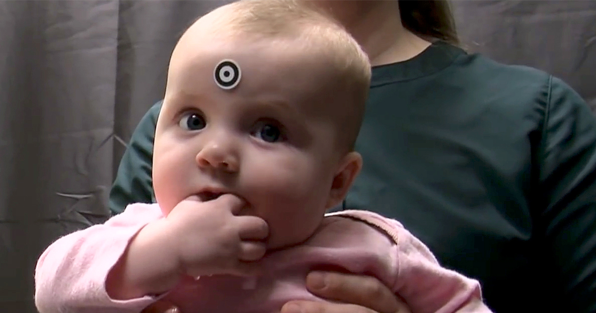 baby with a bullseye on forehead