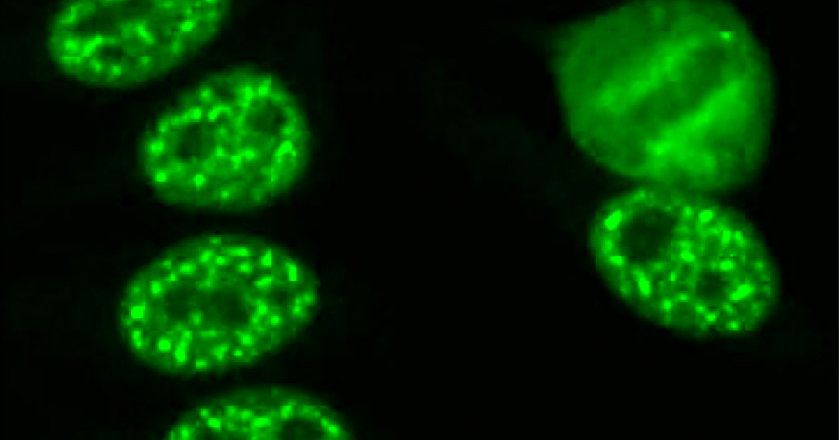 immunofluorescent staining of cells