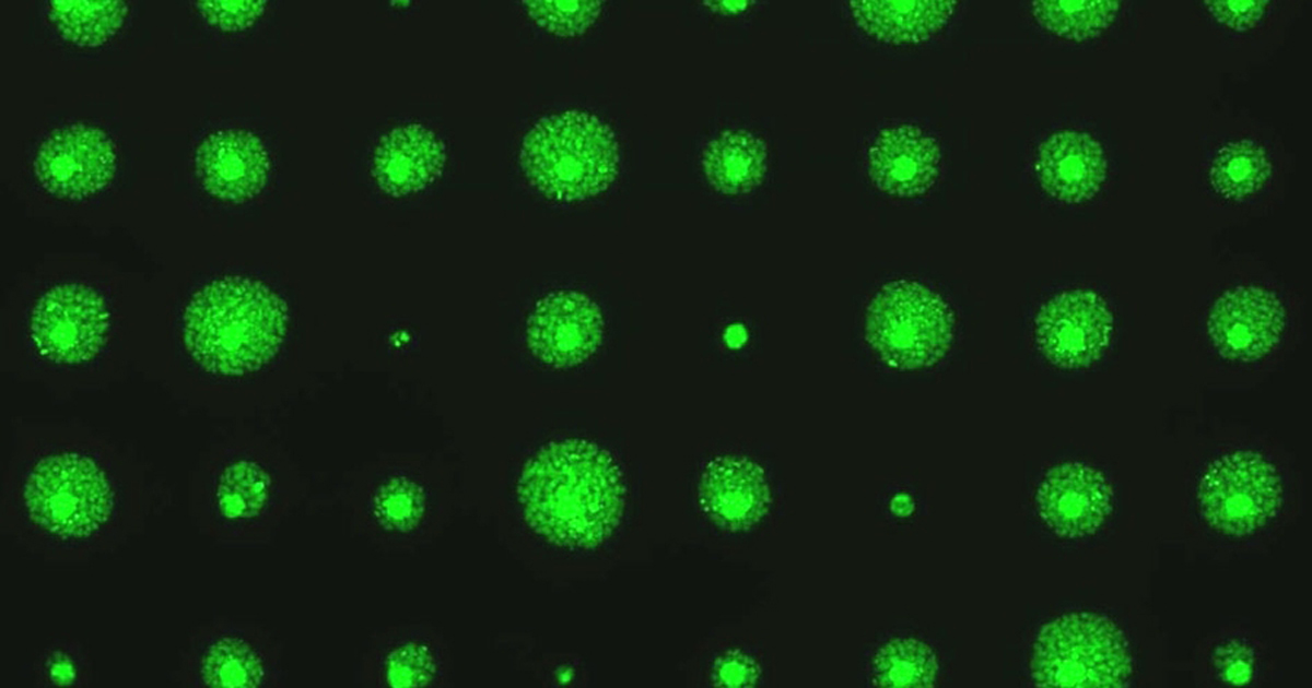 screen showing levels of DNA damage