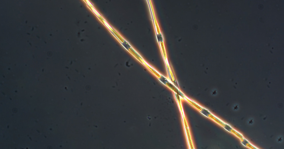 microscopic algae
