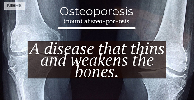 Osteoporosis definition