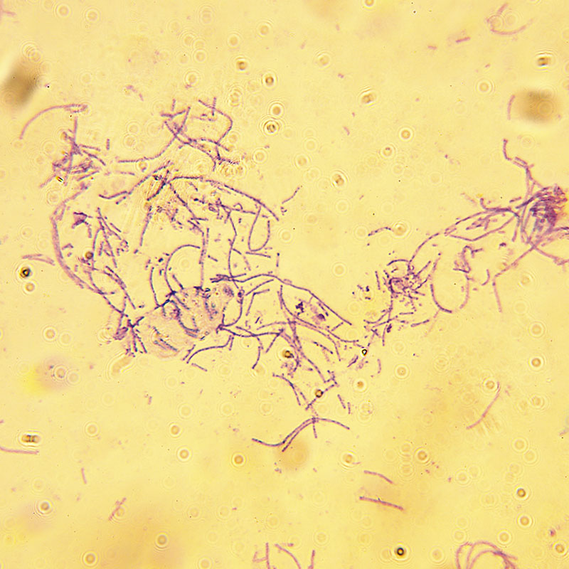 anthrax.jpg