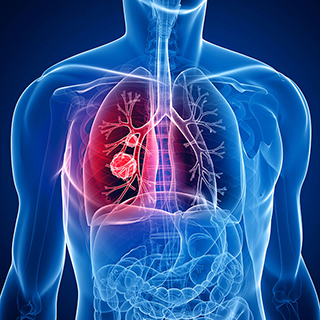 inflammation inside human body