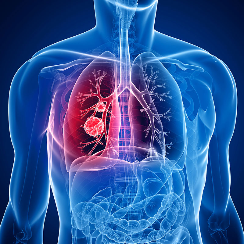 inflammation.jpg