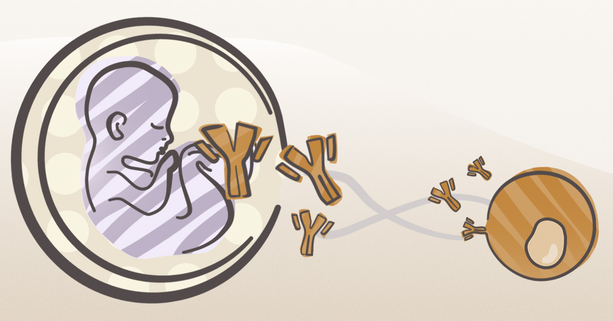 Autism and Environment Seminar