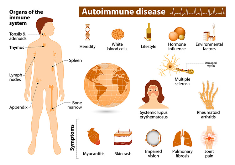 Autoimmune Diseases