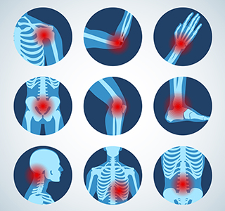 inflammation in x-rays of various joints