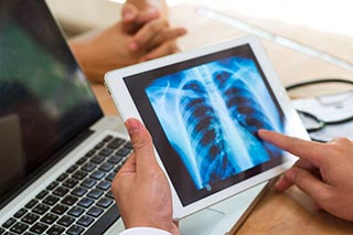 doctor holding tablet with image of lung xray