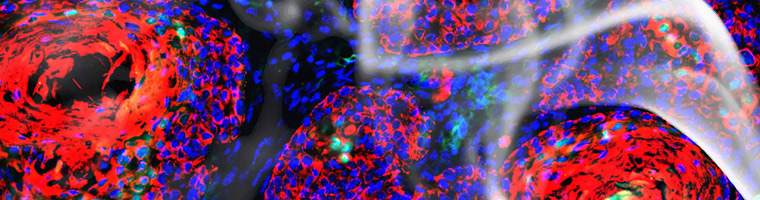 Molecular Signatures of Exposure in Cancer: A Joint NIEHS and NCI Workshop